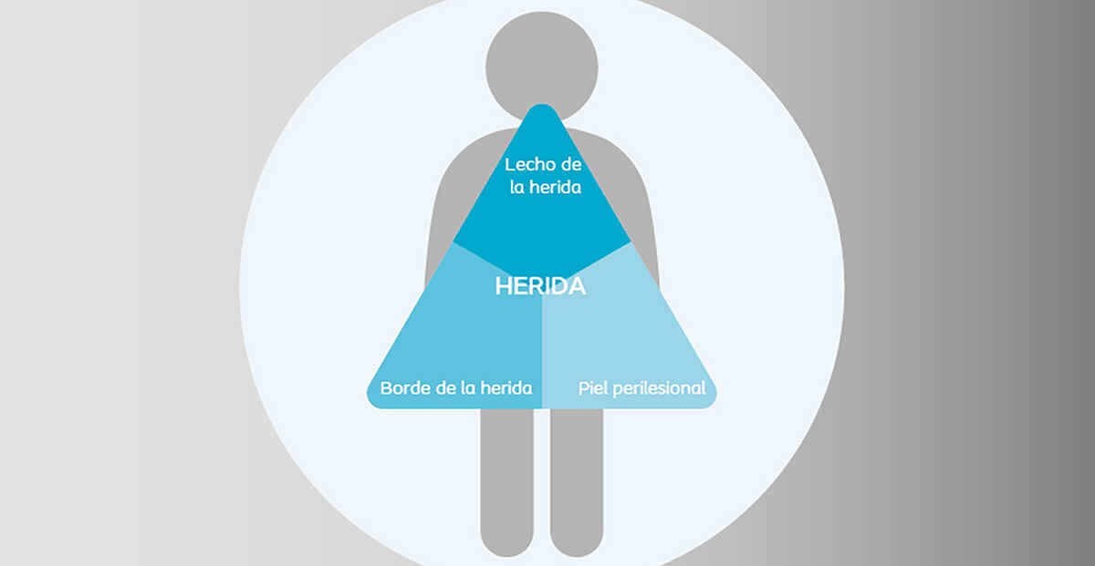 "Abordaje de la herida: valoración y tratamiento"