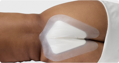 Biatain® Silicone Sacro