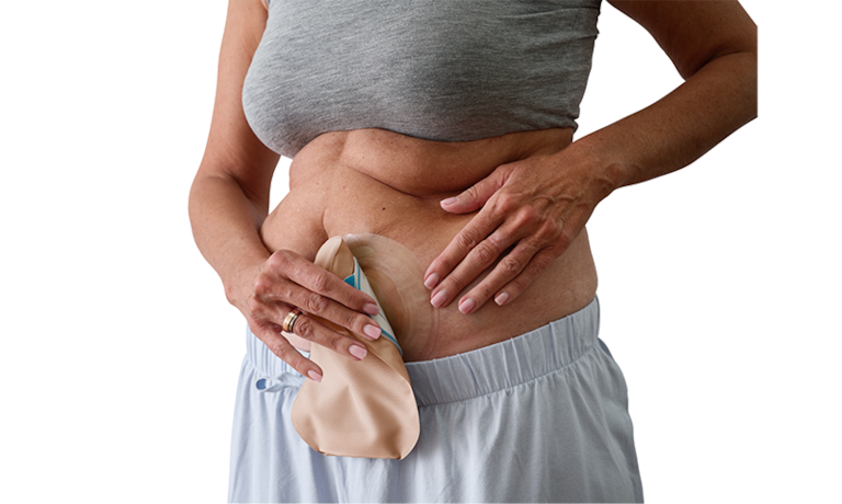 Ostomía